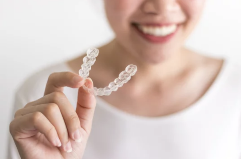 Invisalign Kansas City