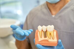 Skilled dental technician posing with a model of dental implant